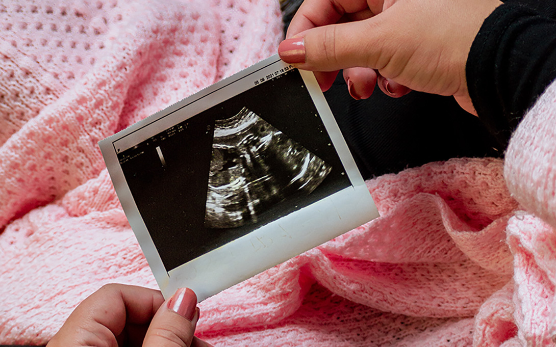 close up image of an expecting mother holding an ultrasound photo
